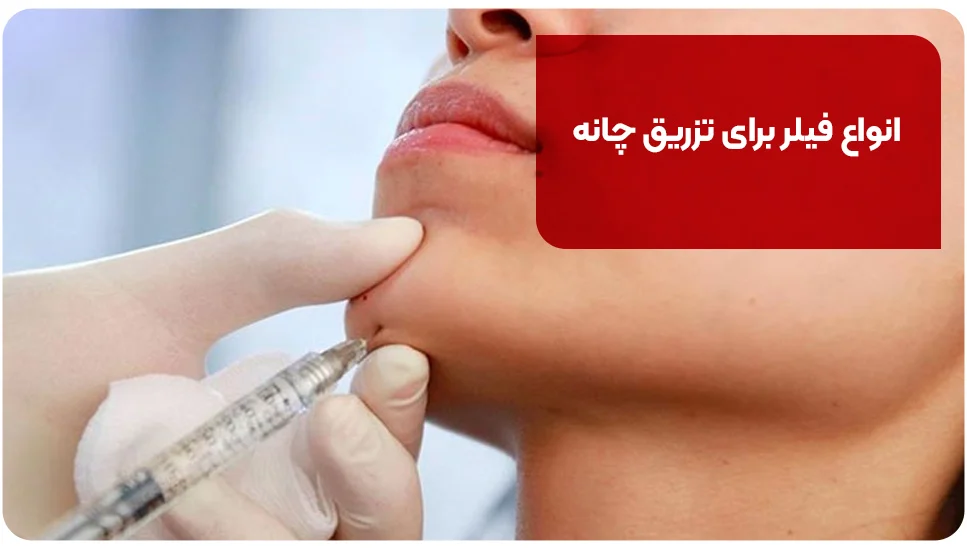 انواع فیلر برای تزریق چانه