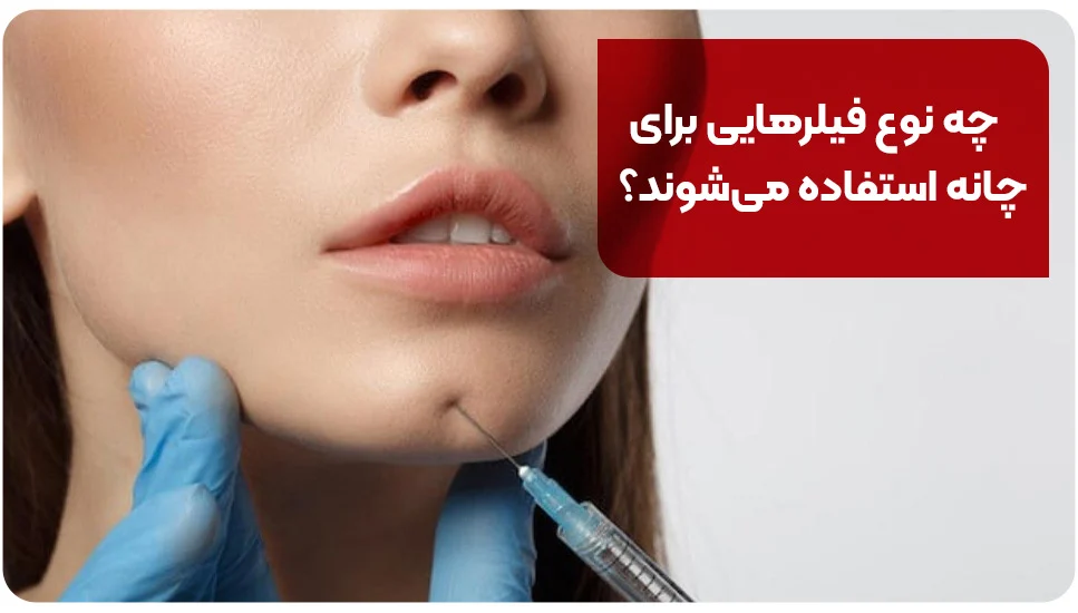 چه نوع فیلرهایی برای چانه استفاده می شوند؟