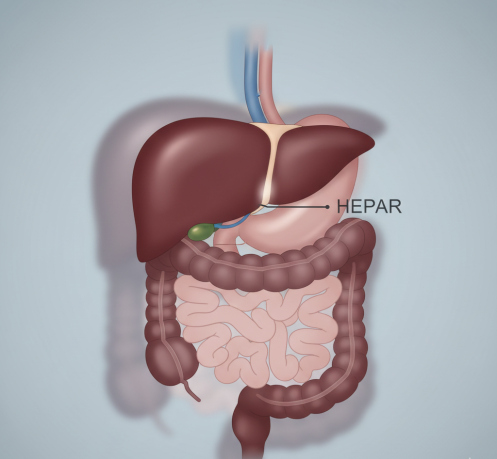 بیماری | آزمایش کبد چرب